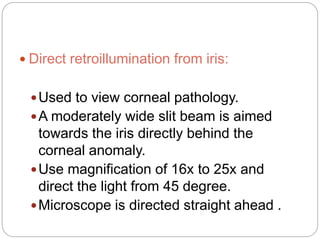  Direct retroillumination from iris:
Used to view corneal pathology.
A moderately wide slit beam is aimed
towards the iris directly behind the
corneal anomaly.
Use magnification of 16x to 25x and
direct the light from 45 degree.
Microscope is directed straight ahead .
 