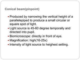 Slit  Lamp Biomicroscopy Slide 34