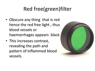 • Obscure any thing that is red
hence the red free light , thus
blood vessels or
haemorrhages appears black
• This increases contrast,
revealing the path and
pattern of inflammed blood
vessels.
Red free(green)filter
 