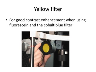 Yellow filter
• For good contrast enhancement when using
fluorescein and the cobalt blue filter
 