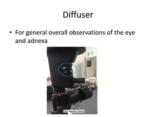 Diffuser
• For general overall observations of the eye
and adnexa
 