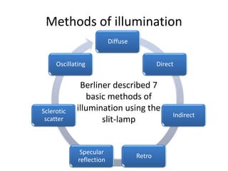 Diffuse
Direct
Indirect
Retro
Specular
reflection
Sclerotic
scatter
Oscillating
Methods of illumination
Berliner described 7
basic methods of
illumination using the
slit-lamp
 