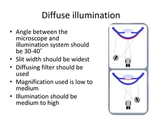 Diffuse illumination
• Angle between the
microscope and
illumination system should
be 30-40˚
• Slit width should be widest
• Diffusing filter should be
used
• Magnification used is low to
medium
• Illumination should be
medium to high
 