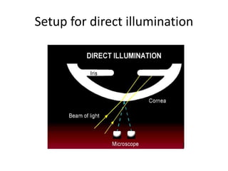 Setup for direct illumination
 