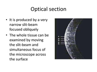 Optical section
• It is produced by a very
narrow slit-beam
focused obliquely
• The whole tissue can be
examined by moving
the slit-beam and
simultaneous focus of
the microscope across
the surface
 