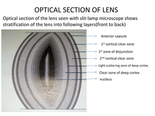 OPTICAL SECTION OF LENS
Optical section of the lens seen with slit-lamp microscope shows
stratification of the lens into following layers(front to back)
Anterior capsule
1st cortical clear zone
1st zone of disjunction
2nd cortical clear zone
Light scattering zone of deep cortex
Clear zone of deep cortex
nucleus
 