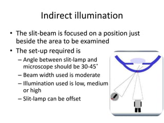 Indirect illumination
• The slit-beam is focused on a position just
beside the area to be examined
• The set-up required is
– Angle between slit-lamp and
microscope should be 30-45˚
– Beam width used is moderate
– Illumination used is low, medium
or high
– Slit-lamp can be offset
 