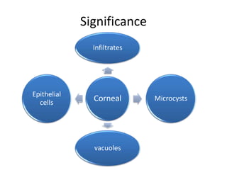Significance
Corneal
Infiltrates
Microcysts
vacuoles
Epithelial
cells
 