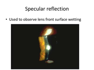 Specular reflection
• Used to observe lens front surface wetting
 
