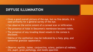 DIFFUSE ILLUMINATION 
• Gives a good overall picture of the eye, but no fine details. It is 
used primarily for a general survey of the eye. 
• Can observe the entire extent of a corneal scar or infiltration. 
• The presence of folds in Descemet's membrane become visible. 
• The presence of any invading blood vessels in the cornea is 
disclosed. 
• Edema of the epithelium may be indicated by a hazy, gray, and 
somewhat granular appearance. 
• Observe: eyelids, lashes, conjunctiva, sclera, pattern of redness, 
iris, pupil, gross pathology, and media opacities 
 