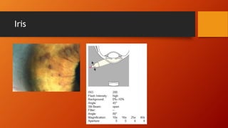 Iris 
 