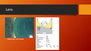 Lens 
• Moderate slit beam 
 