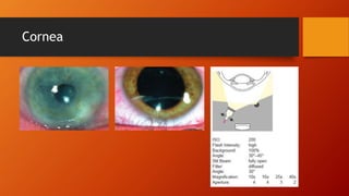 Cornea 
 