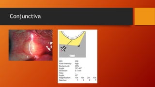 Conjunctiva 
 