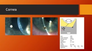 Cornea 
 