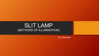 SLIT LAMP 
(METHODS OF ILLUMINATION) 
By: Maclester 
 