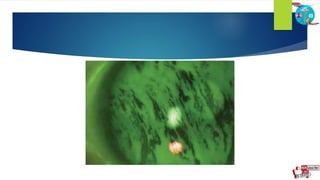 Slit Lamp Function Slit lamp | PPTX