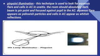 ● pinpoint illumination - this technique is used to look for aqueous
flare and cells in AC in uveitis. the room should absolutely dark.
beam is pin point and focused against pupil in the AC. aqueous flare
appears as yellowish particles and cells in AC appear as whitish
reflections.
 