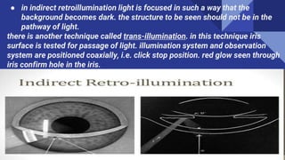 ● in indirect retroillumination light is focused in such a way that the
background becomes dark. the structure to be seen should not be in the
pathway of light.
there is another technique called trans-illumination. in this technique iris
surface is tested for passage of light. illumination system and observation
system are positioned coaxially, i.e. click stop position. red glow seen through
iris confirm hole in the iris.
 