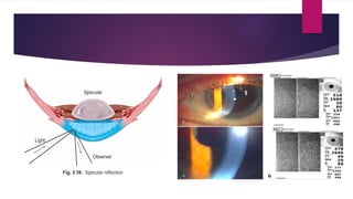 Slit Slide Slit Lamp Biomicroscopy: Principles, Components, Illumination ...