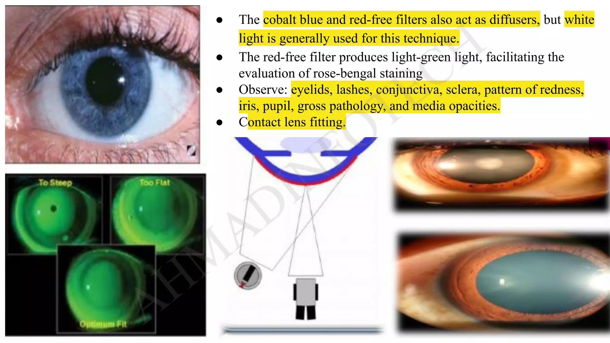 what is slit lamp Biomicroscopy | What is a slit lamp exam used for ...
