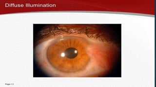 Slit_lamp_and_bio_microscopy_.pptx