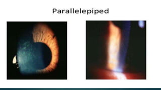 Slit_lamp_and_bio_microscopy_.pptx