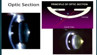 Slit_lamp_and_bio_microscopy_.pptx