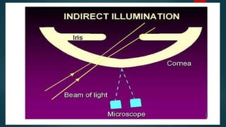 Slit_lamp_and_bio_microscopy_.pptx
