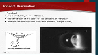 Slit_lamp_and_bio_microscopy_.pptx