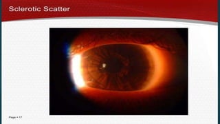 Slit_lamp_and_bio_microscopy_.pptx