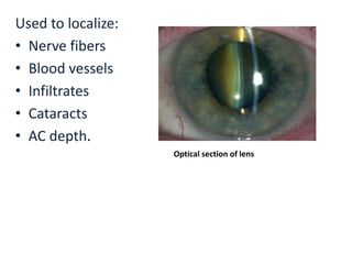 Used to localize:
• Nerve fibers
• Blood vessels
• Infiltrates
• Cataracts
• AC depth.
Optical section of lens
 
