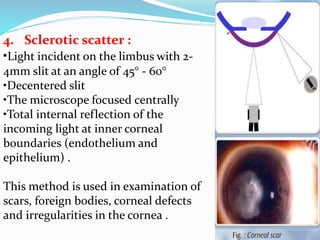 Slit lamp biomicroscope | PPTX