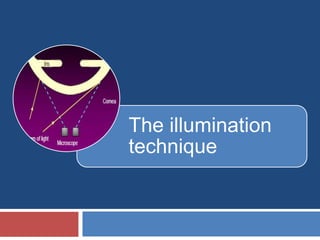 The illumination
technique
 