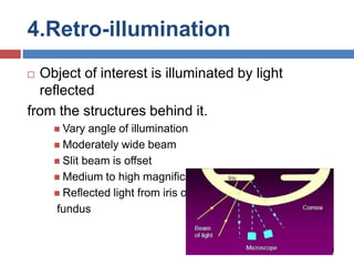 4.Retro-illumination
 Object of interest is illuminated by light
reflected
from the structures behind it.
 Vary angle of illumination
 Moderately wide beam
 Slit beam is offset
 Medium to high magnification
 Reflected light from iris or
fundus
 