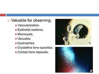  Valuable for observing:
 Vascularization.
 Epithelial oedema.
 Microcysts.
 Vacuoles.
 Dystrophies.
 Crystalline lens opacities.
 Contact lens deposits.
 