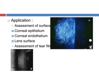  Application :
 Assessment of surfaces
 Corneal epithelium
 Corneal endothelium
 Lens surface
 Assessment of tear film
 