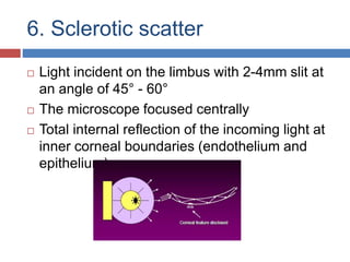 6. Sclerotic scatter
 Light incident on the limbus with 2-4mm slit at
an angle of 45° - 60°
 The microscope focused centrally
 Total internal reflection of the incoming light at
inner corneal boundaries (endothelium and
epithelium)
 