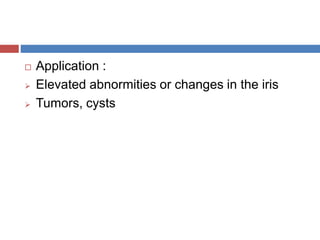  Application :
 Elevated abnormities or changes in the iris
 Tumors, cysts
 