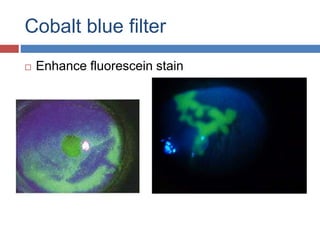 Cobalt blue filter
 Enhance fluorescein stain
 