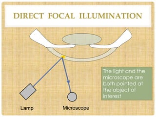 Slit lamp biomicroscopy | PPTX