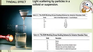 TYNDALL EFFECT Light scattering by particles in a
colloid or suspension.
 