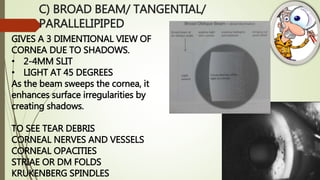 C) BROAD BEAM/ TANGENTIAL/
PARALLELIPIPED
GIVES A 3 DIMENTIONAL VIEW OF
CORNEA DUE TO SHADOWS.
• 2-4MM SLIT
• LIGHT AT 45 DEGREES
As the beam sweeps the cornea, it
enhances surface irregularities by
creating shadows.
TO SEE TEAR DEBRIS
CORNEAL NERVES AND VESSELS
CORNEAL OPACITIES
STRIAE OR DM FOLDS
KRUKENBERG SPINDLES
 
