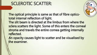 SCLEROTIC SCATTER:
The optical principle is same as that of fibre optics-
total internal reflection of light.
The slit beam is directed at the limbus from where the
sclera scatters the light. Some of this enters the corneal
stroma and travels the entire cornea getting internally
reflected.
An opacity causes light to scatter and be visualised by
the examiner.
 