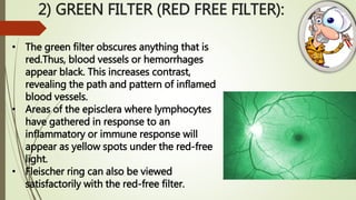 2) GREEN FILTER (RED FREE FILTER):
• The green filter obscures anything that is
red.Thus, blood vessels or hemorrhages
appear black. This increases contrast,
revealing the path and pattern of inflamed
blood vessels.
• Areas of the episclera where lymphocytes
have gathered in response to an
inflammatory or immune response will
appear as yellow spots under the red-free
light.
• Fleischer ring can also be viewed
satisfactorily with the red-free filter.
 