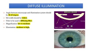 SLIT LAMP BIOMICROSCOPY Dr. Debarnab Dey | PPTX