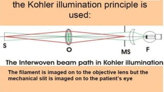 SLIT LAMP BIOMICROSCOPY EXAMINATION.pptx