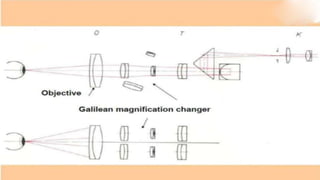 SLIT LAMP BIOMICROSCOPY EXAMINATION.pptx
