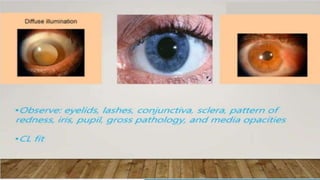 SLIT LAMP BIOMICROSCOPY EXAMINATION.pptx
