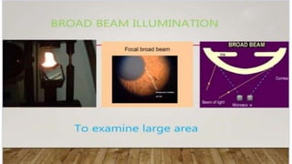 SLIT LAMP BIOMICROSCOPY EXAMINATION.pptx